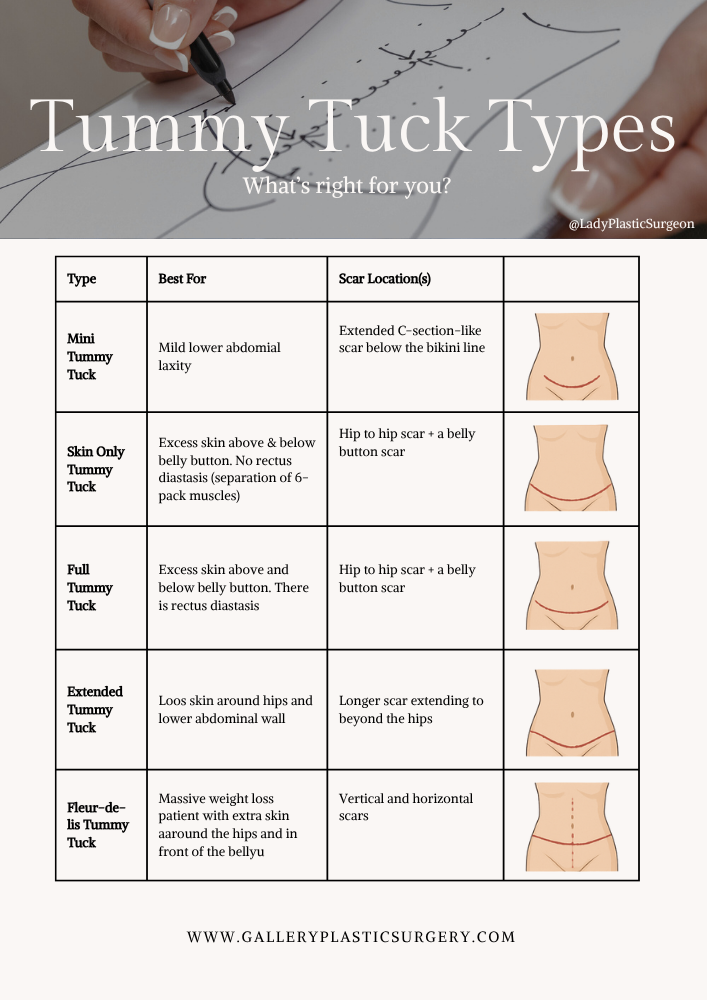 The Thrive Guide: Tummy Tuck Surgery